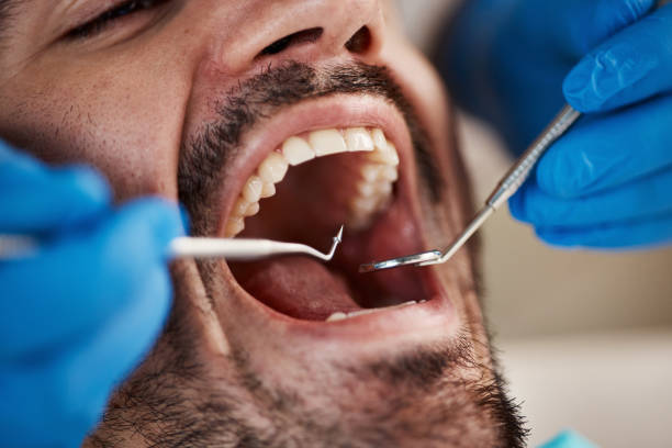Best Emergency Dental Services for Seniors in Hudson, PA